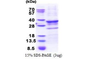 SDS-PAGE (SDS) image for Centromere Protein Q (CENPQ) (AA 1-268) protein (His tag) (ABIN5853442) (CENPQ Protein (AA 1-268) (His tag))