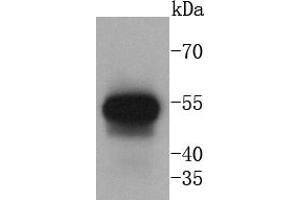 Human lung lysates probed with Cytokeratin 13 (5A3) Monoclonal Antibody at 1:1000 overnight at 4˚C. (Cytokeratin 13 antibody)