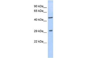 WB Suggested Anti-LIX1 Antibody Titration: 0.