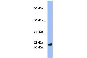 SPRR3 antibody used at 1 ug/ml to detect target protein. (SPRR3 antibody  (Middle Region))