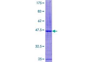 Image no. 1 for Cystatin F (Leukocystatin) (CST7) (AA 1-167) protein (GST tag) (ABIN1350590) (CST7 Protein (AA 1-167) (GST tag))