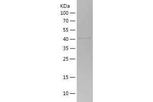 Western Blotting (WB) image for Phosphoinositide 3 Kinase, p85 alpha (PI3K p85a) (AA 44-201) protein (His-IF2DI Tag) (ABIN7124425) (PIK3R1 Protein (AA 44-201) (His-IF2DI Tag))