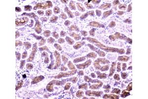 IHC analysis of PON1 using anti-PON1 antibody (ABIN6719356). (PON1 antibody  (AA 30-274))