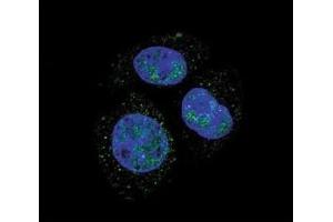 Confocal immunofluorescent analysis of p-Rb1 antibody with HepG2 cells followed by Alexa Fluor 488-conjugated goat anti-rabbit lgG (green). (Retinoblastoma Protein (Rb) antibody  (pSer811))