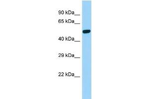 Host:  Rabbit  Target Name:  Psen2  Sample Type:  Rat Stomach lysates  Antibody Dilution:  1.
