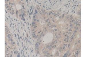 Immunohistochemistry (IHC) image for anti-Ubiquitin A-52 Residue Ribosomal Protein Fusion Product 1 (UBA52) (AA 1-128) antibody (ABIN7441190)