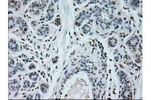 Immunohistochemical staining of paraffin-embedded breast tissue using anti-NEUROG1 mouse monoclonal antibody. (Neurogenin 1 antibody)