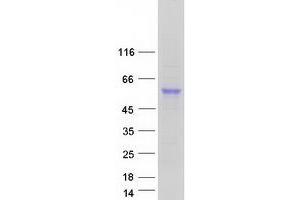 Validation with Western Blot (CPVL Protein (Transcript Variant 2) (Myc-DYKDDDDK Tag))