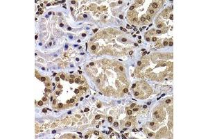 Immunohistochemistry of paraffin-embedded human kidney using DNAJB6 antibody. (DNAJB6 antibody  (AA 177-326))