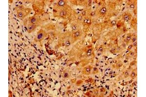 Immunohistochemistry of paraffin-embedded human liver tissue using ABIN7175121 at dilution of 1:100 (Urocortin 2 antibody  (AA 72-112))