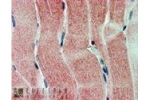 Immunohistochemistry (IHC) image for anti-Sirtuin 4 (SIRT4) (C-Term) antibody (ABIN2466271) (SIRT4 antibody  (C-Term))