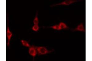 ABIN6267219 staining Hela by IF/ICC. (NFKBIE antibody  (pSer161))