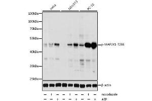 Western blot analysis of extracts of various cell lines, using Phospho-MAP2K1-T286 antibody. (MEK1 antibody  (pThr286))