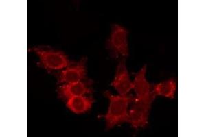 ABIN6278557 staining HepG2 by IF/ICC. (CCRL2 antibody  (Internal Region))