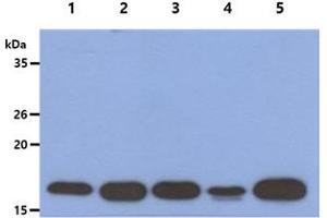 The Cell lysates (40ug) were resolved by SDS-PAGE, transferred to PVDF membrane and probed with anti-human ACP1 antibody (1:1000). (ACP1 antibody)