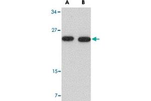 Western blot analysis of POFUT1 in human heart tissue lysate with POFUT1 polyclonal antibody  at (A) 0.