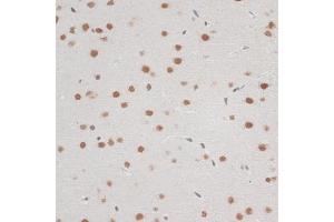 Immunohistochemistry of paraffin-embedded mouse brain using ZNF148 antibody (ABIN6130815, ABIN6150463, ABIN6150464 and ABIN6222770) at dilution of 1:100 (40x lens). (ZNF148 antibody  (AA 690-794))