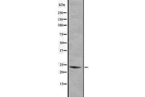 Western blot analysis of GEM expression in 293 lysate,The lane on the left is treated with the antigen-specific peptide. (GEM antibody  (N-Term))