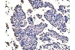 IHC analysis of splicing factor 1 using anti-splicing factor 1 antibody (ABIN7600194). (Splicing Factor 1 antibody  (AA 160-266))