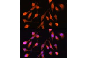 Immunofluorescence analysis of HeLa cells using PPM1A Rabbit pAb (ABIN6132507, ABIN6146039, ABIN6146040 and ABIN6222411) at dilution of 1:100 (40x lens). (PPM1A antibody  (AA 1-382))