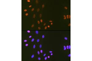 Immunofluorescence analysis of C6 cells using DNA Ligase I Rabbit mAb (ABIN7268251) at dilution of 1:100 (40x lens). (LIG1 antibody)