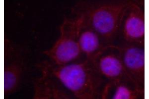 Immunofluorescence analysis of methanol-fixed MCF-7 cells using Phospho-Estrogen Receptor alpha(S118) Polyclonal Antibody (Estrogen Receptor alpha antibody  (pSer118))