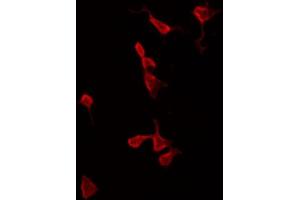 ABIN6269292 staining HeLa by IF/ICC. (Calmodulin 1 antibody)