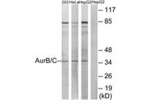 Western blot analysis of extracts from 293/HeLa/HepG2 cells, treated with Paclitaxel 1uM 24h, using AurB/C (Ab-202/175) Antibody. (AurB/C antibody  (AA 201-250))