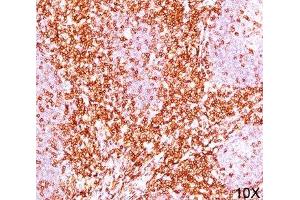 IHC testing of human tonsil (10X) stained with CD6 antibody cocktail (C6/372 + 3F7B5). (CD6 antibody)