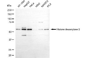Western blotting analysis using histone deacetylase 2 antibody (ABIN7798930).