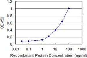 Detection limit for recombinant GST tagged SLPI is 0. (SLPI antibody  (AA 33-132))