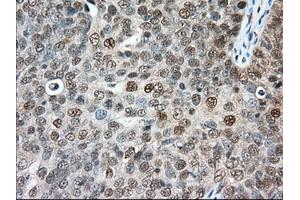 Immunohistochemical staining of paraffin-embedded Human colon tissue using anti-ERCC1 mouse monoclonal antibody.