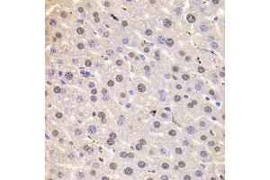 Immunohistochemistry of paraffin-embedded Mouse liver using HNRNPD antibody at dilution of 1:100 (x400 lens). (HNRNPD/AUF1 antibody)