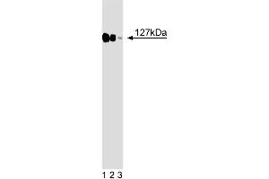 Western blot analysis of DDB1 on a HeLa cell lysate (Human cervical epitheloid carcinoma, ATCC CCL-2. (DDB1 antibody  (AA 739-935))