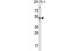 Western Blotting (WB) image for anti-Telomeric Repeat Binding Factor 2 (TERF2) antibody (ABIN2997581)