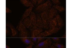 Immunofluorescence analysis of U-2 OS cells using SEPT8 Polyclonal Antibody at dilution of 1:100. (Septin 8 antibody)
