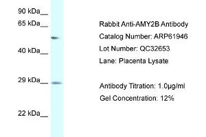 Western Blotting (WB) image for anti-Amylase, alpha 2B (Pancreatic) (AMY2B) (N-Term) antibody (ABIN2774328) (AMY2B antibody  (N-Term))