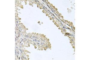 Immunohistochemistry of paraffin-embedded human prostate using CDH5 antibody at dilution of 1:100 (x40 lens). (Cadherin 5 antibody)