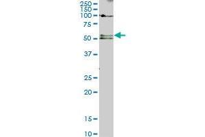 SMAD5 monoclonal antibody (M01), clone 2D7. (SMAD5 antibody  (AA 105-182))