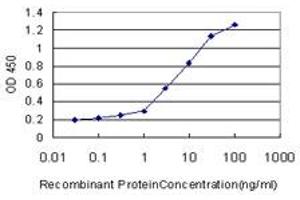 Detection limit for recombinant GST tagged FBXO11 is approximately 0. (FBXO11 antibody  (AA 744-843))