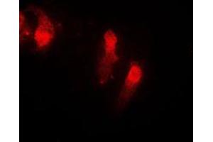 Immunofluorescent analysis of Cystatin B staining in EOC20 cells. (CSTB antibody  (Center))