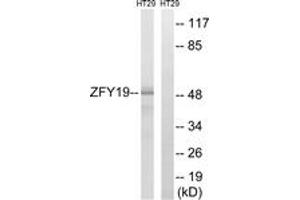Western blot analysis of extracts from HT-29 cells, using ZFYVE19 Antibody. (ZFYVE19 antibody  (AA 311-360))