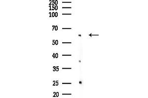anti-Myeloma Overexpressed (MYEOV) (Internal Region) antibody