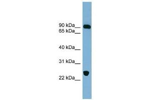 VPS53 antibody used at 1 ug/ml to detect target protein. (VPS53 antibody)