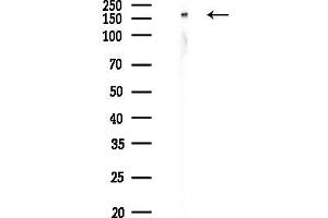 anti-Glutamyl-Prolyl-tRNA Synthetase (EPRS) (pSer886) antibody
