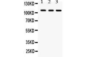 Anti- CYLD Picoband antibody, Western blottingAll lanes: Anti CYLD  at 0.