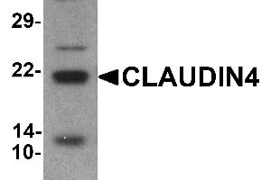 Western blot analysis of CLAUDIN4 in human colon tissue lysate with CLAUDIN4 antibody at 1 µg/mL (Claudin 4 antibody  (C-Term))