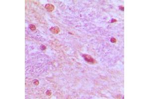 Immunohistochemical analysis of SRSF3 staining in human brain formalin fixed paraffin embedded tissue section. (SRSF3 antibody  (C-Term))