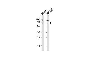 All lanes : Anti-GNL3 Antibody (N-term) at 1:2000 dilution Lane 1: Hela whole cell lysates Lane 2: NCCIT whole cell lysates Lysates/proteins at 20 μg per lane. (Nucleostemin antibody  (N-Term))