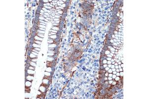 Immunohistochemistry of paraffin-embedded human appendix using Creatine kinase B type (CKB) Rabbit mAb (ABIN7266515) at dilution of 1:100 (40x lens). (CKB antibody)